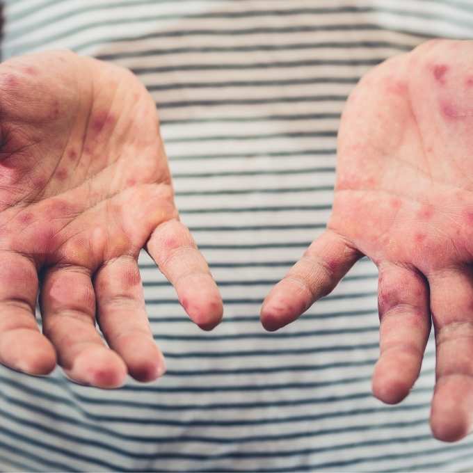 Infectious Disease Cleanup In Kentucky	Near Me